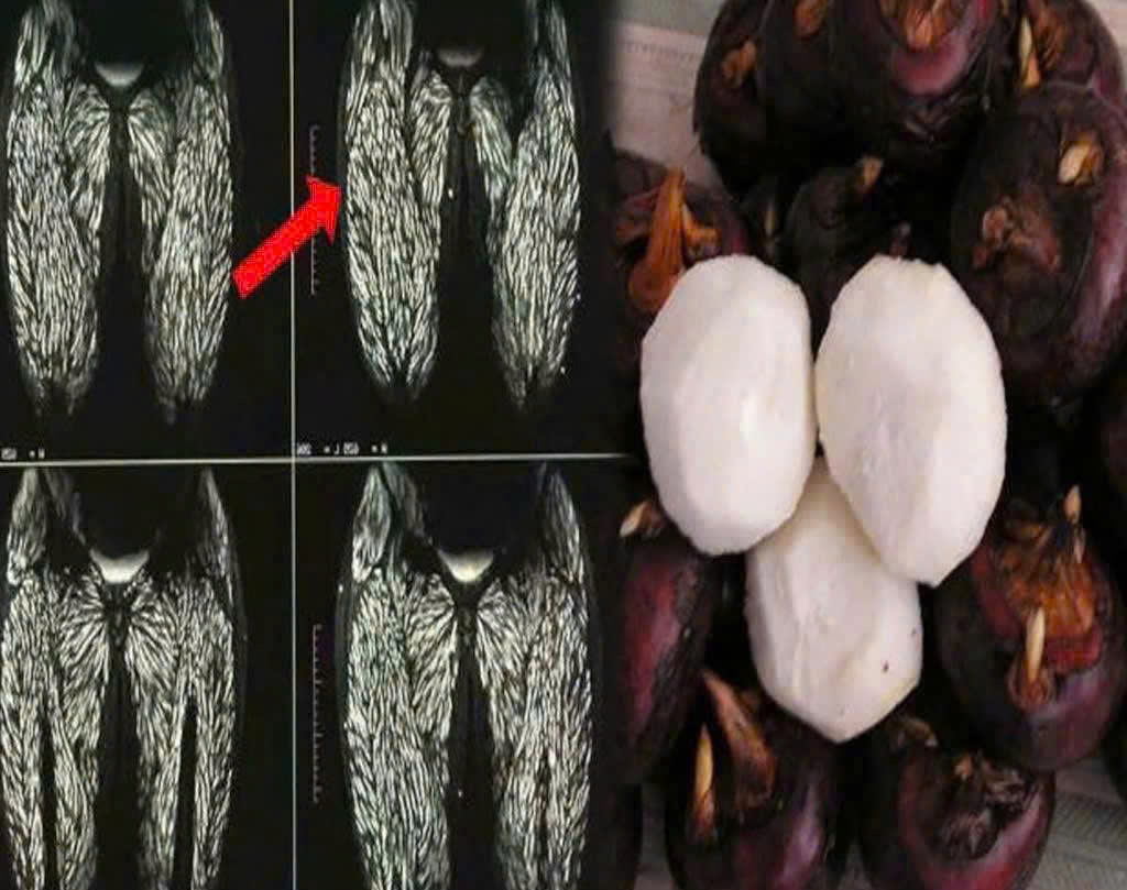 Ăn một miếng tương đương cho 100.000 con ký sinh trùng vào bụng –